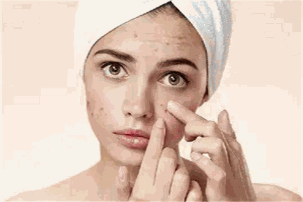 艾菲媛祛斑祛痘